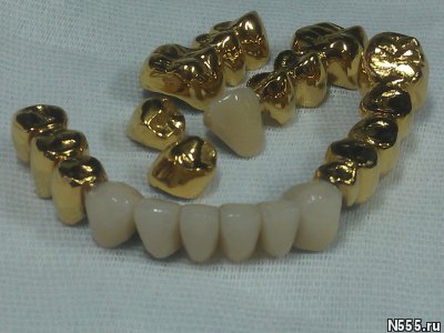 Установки покрытия зубных протезов  под золото фото 1