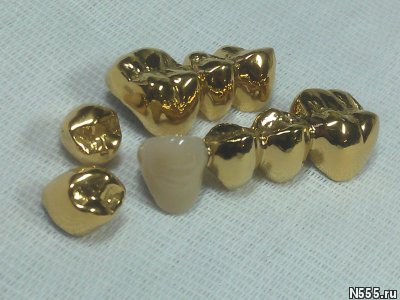 Установки покрытия зубных протезов  под золото фото 3